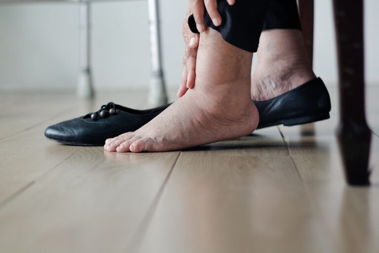piedi gonfi negli anziani: donna con piedi gonfi si infila le scarpe